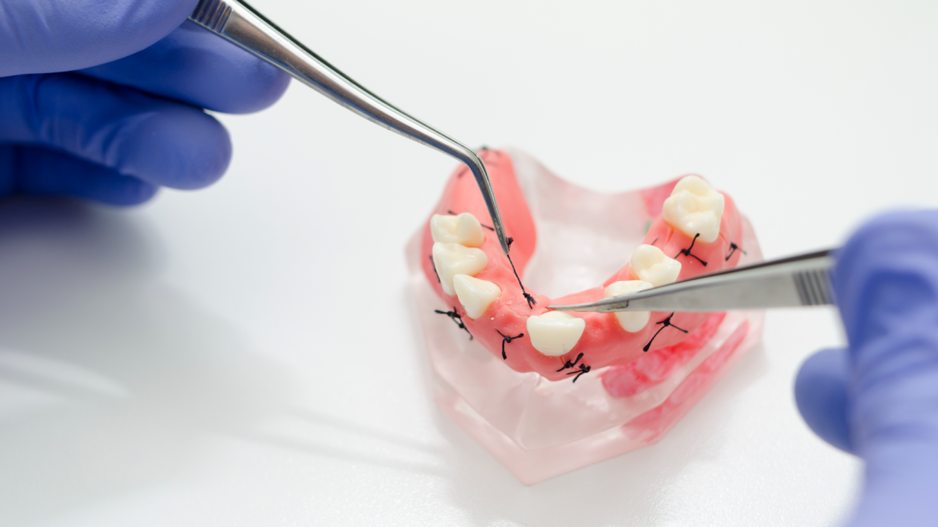 Cirurgia Bucomaxilofacial